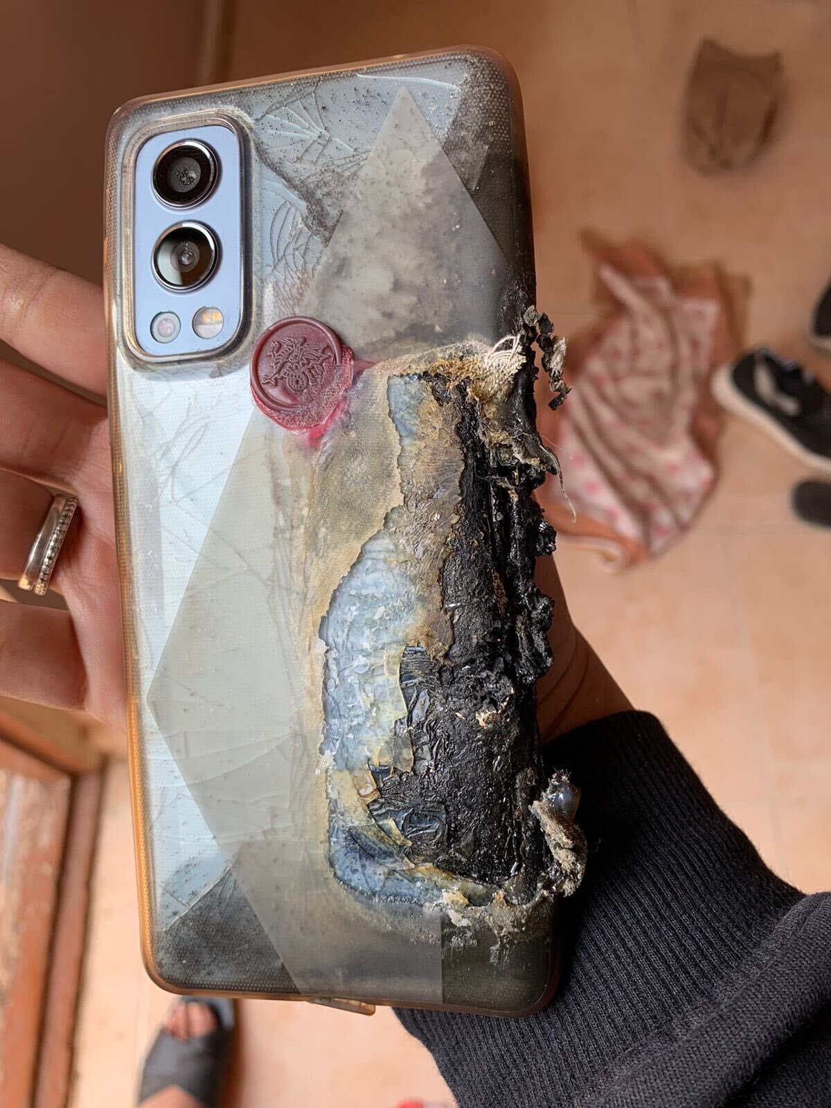 سوختگی شدید یک کاربر به دلیل انفجار گوشی OnePlus Nord ۲